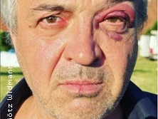 Ein Mann mit grauem Haar und ernstem Gesichtsausdruck hat ein blaues Auge und trägt dunkelblaue Kleidung.