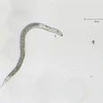 JKI-FadenWurm-Mikroskopaufnahme.jpg
