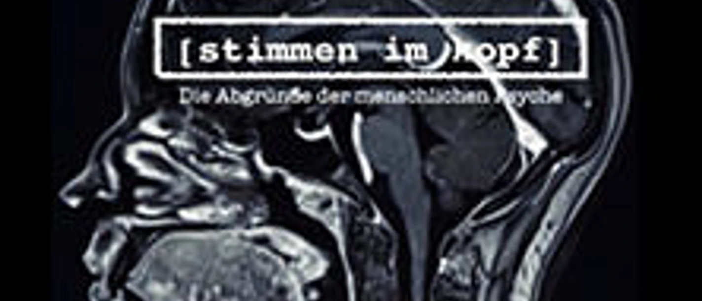 MRI-Scan eines menschlichen Schädels als künstlerische Darstellung.