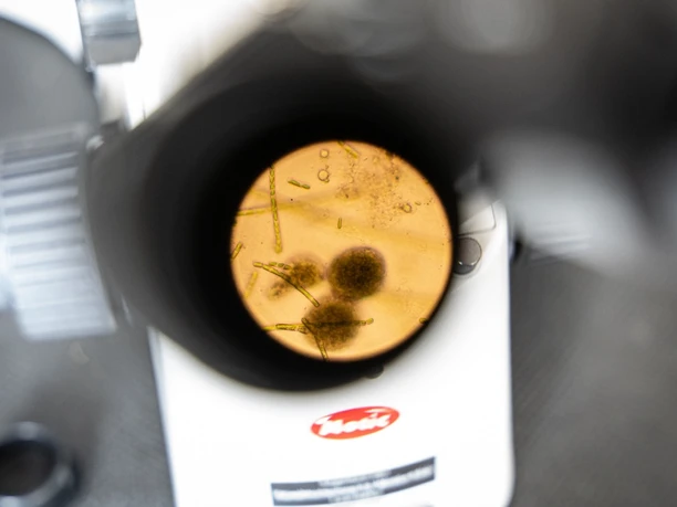 View through a microscope onto a Petri dish with microorganisms.